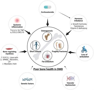 Poor bone health in Duchenne muscular dystrophy: a multifactorial problem beyond corticosteroids and loss of ambulation